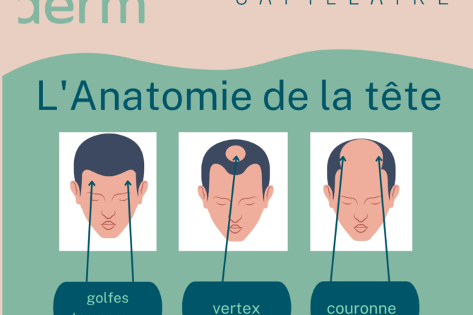 Décrire ma perte de cheveux avec les mots justes.