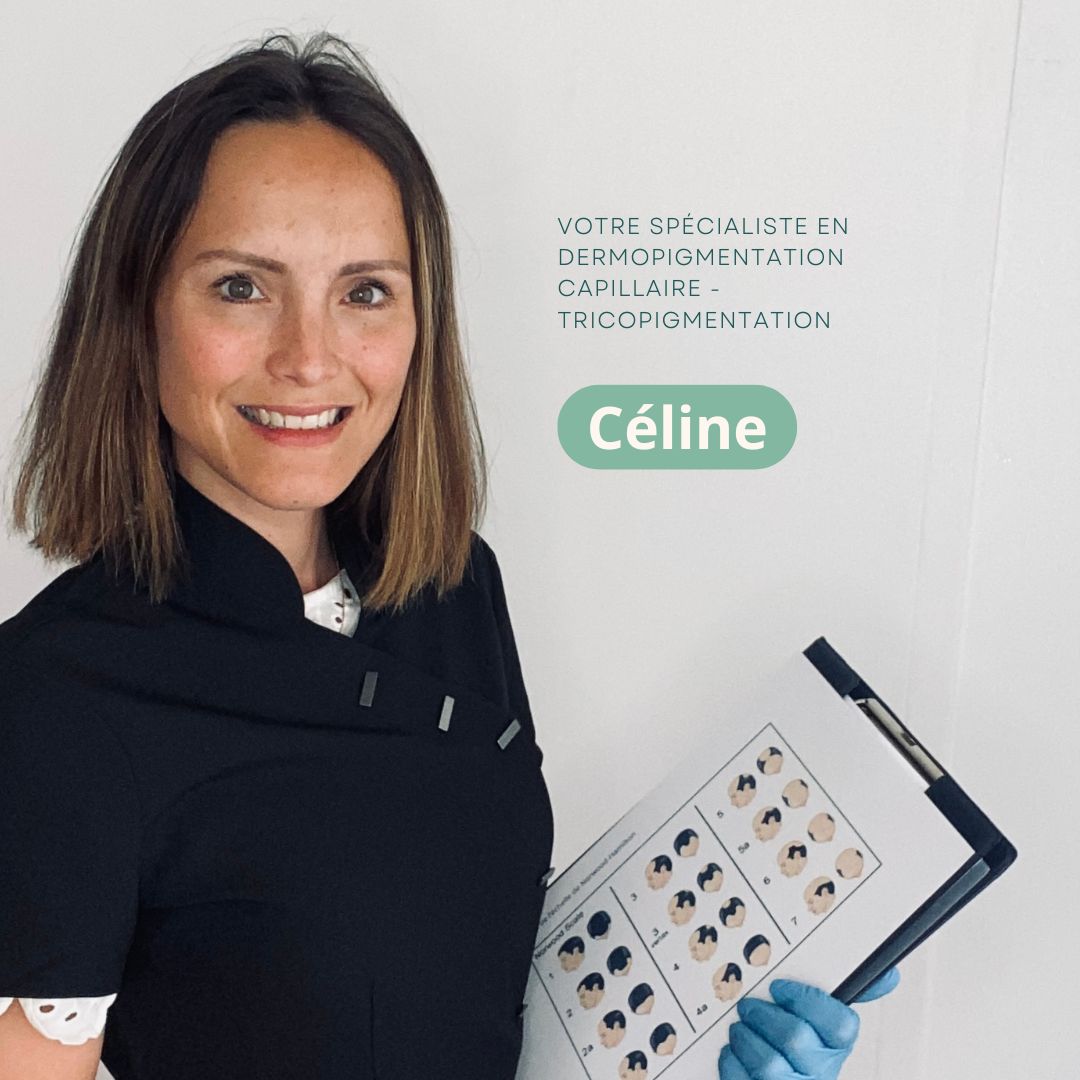 Tricopigmentiste, dermographe, je prend soin de vous et propose une solution pour camoufler votre perte de cheveux. Arkéderm à Annecy propose une alternative à la greffe de cheveux, et vient cacher les cicatrices post greffes fue, fut.